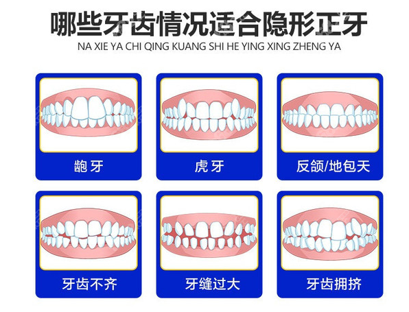 成都新桥口腔正畸怎么样