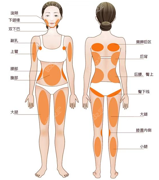 腰腹环吸12个部位图图片