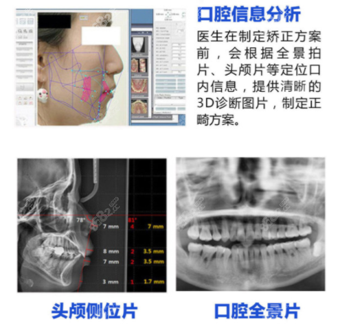 成都新桥口腔牙齿矫正怎么样