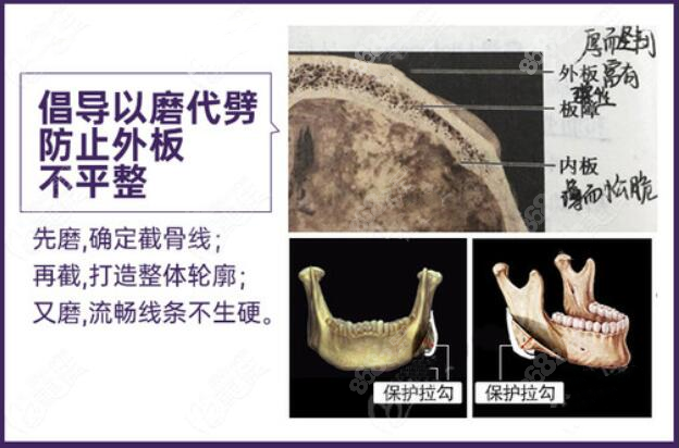 以磨骨代替直接劈开的优势