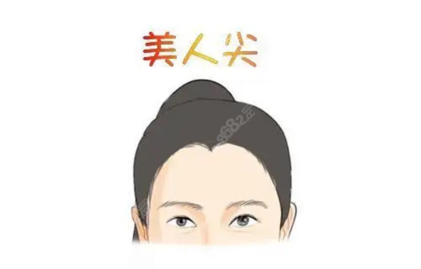 植发美人尖需要多少钱单位