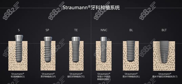 瑞士士卓曼不同的植体