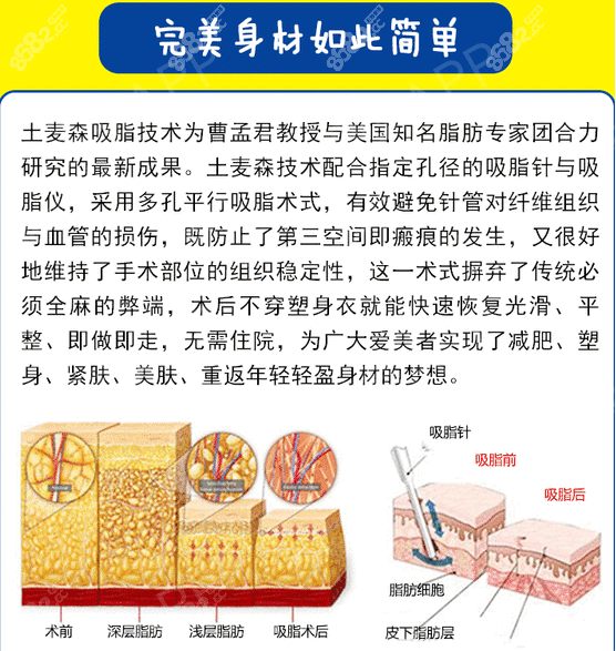 土麦森吸脂和普通吸脂区别