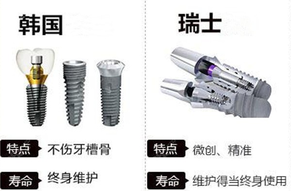 种植牙瑞士和德国的哪个好