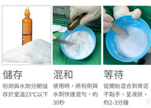 骨水泥填充手术过程