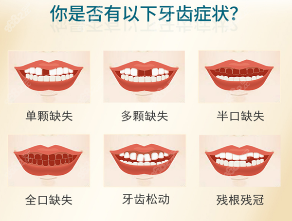 云浮牙科收费标准