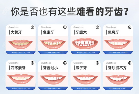 南宁蓝天口腔做牙齿贴面的类型