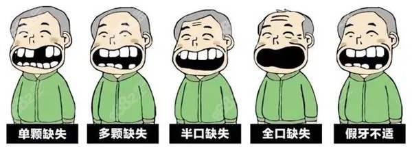 集采种植牙会降价吗