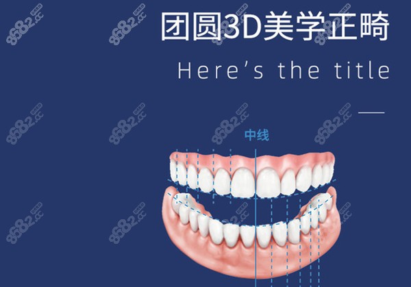 成都团圆口腔3D美学牙齿矫正技术展示