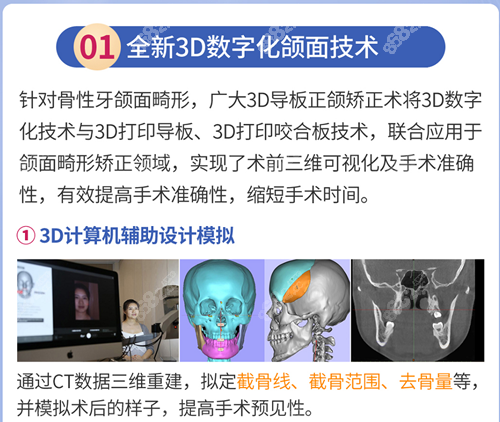 广大医院正颌技术