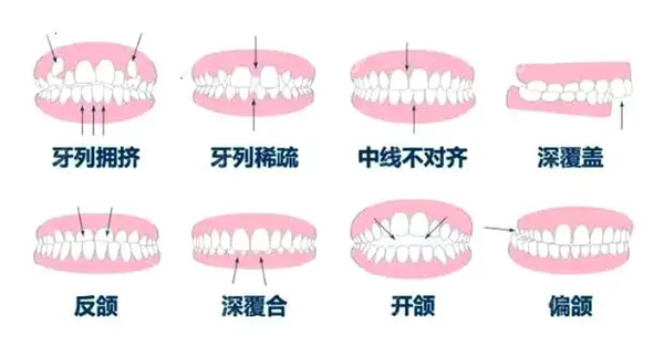 桂林正畸好点的医生