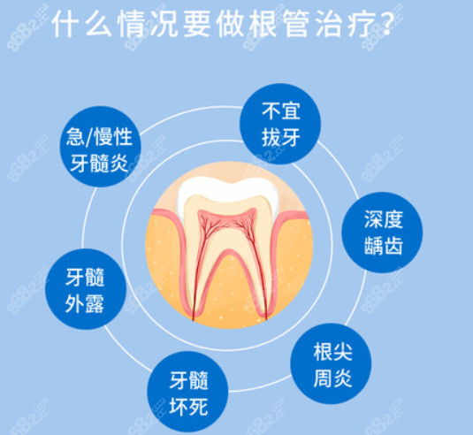 南宁蓝天口腔常做的根管治疗症状