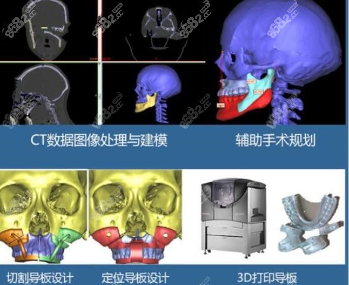 广大医院正颌技术优势