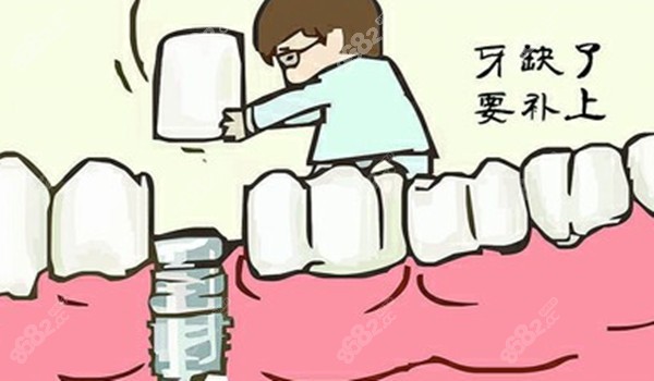 德国贝格bego和瑞士iti哪个好
