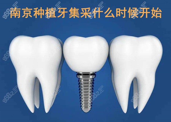 种植牙集采什么时候落地