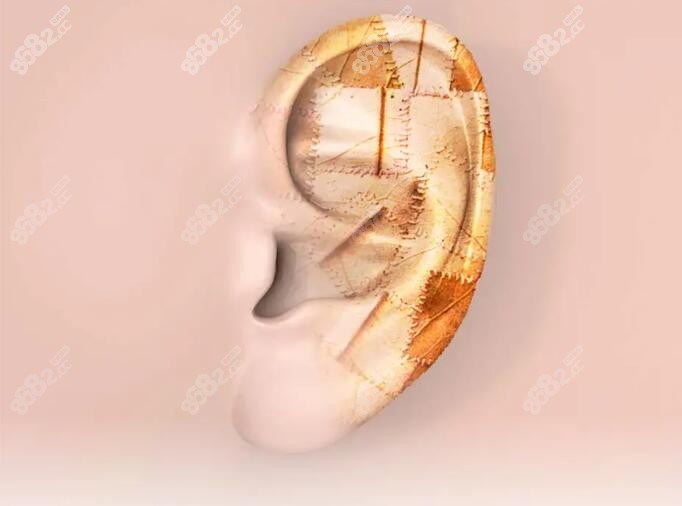 耳朵整形医院卡通图片