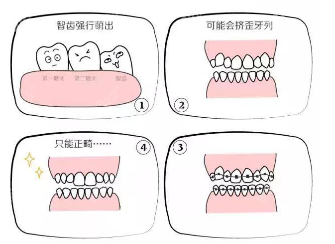 山东日照福平口腔正畸示意图