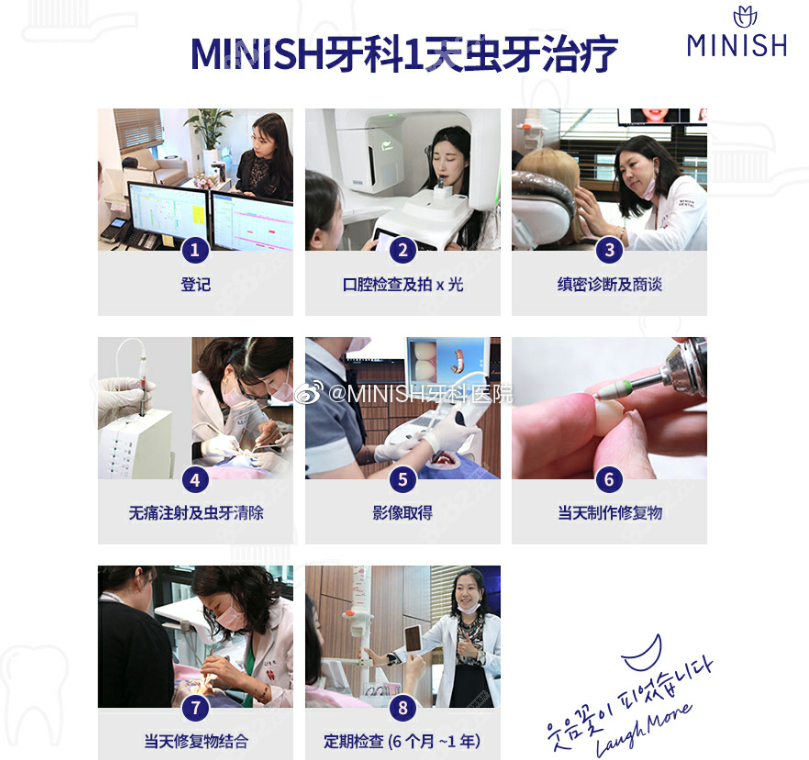 MINISH贴面的特点