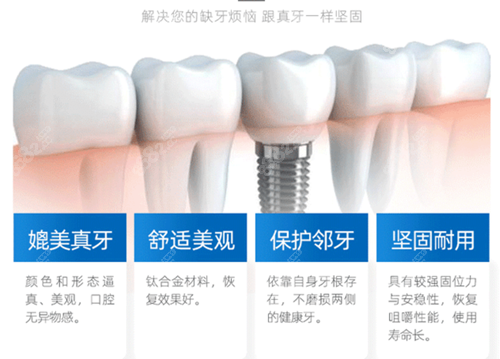 杭州美奥口腔医院种植牙