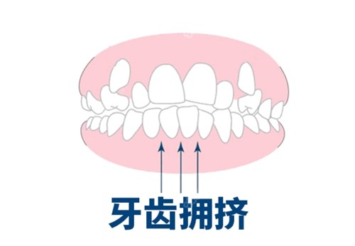 中等难度正畸病例