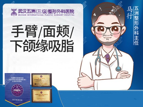 武汉马行医生也是武汉面部吸脂有名的医生