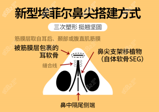 杭州维多利亚唐红伟隆鼻技术