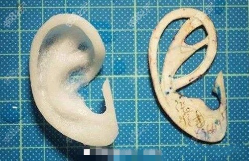 四川省人民医院东篱医院段伟强雕刻的耳部支架