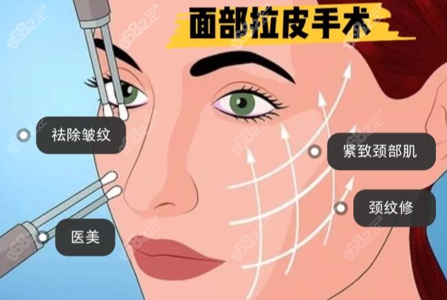m.8682.cc韩国面部拉皮提升医院排名前十