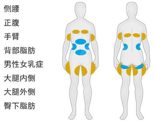 王世虎做吸脂需要点名费吗？