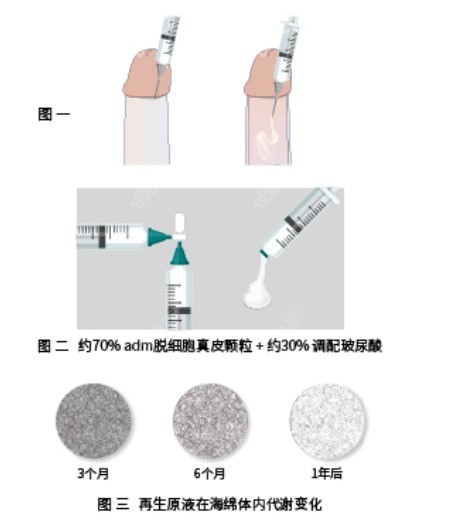 重庆星荣微创·再生原液男性增粗