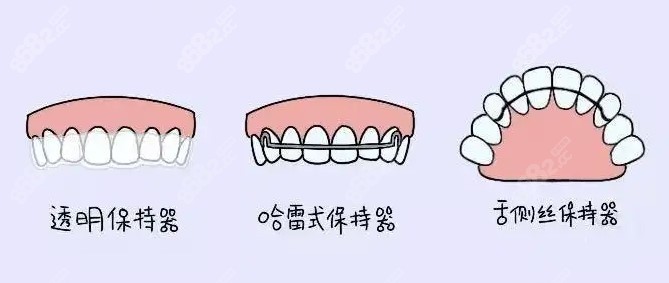 成人牙齿矫正器价格