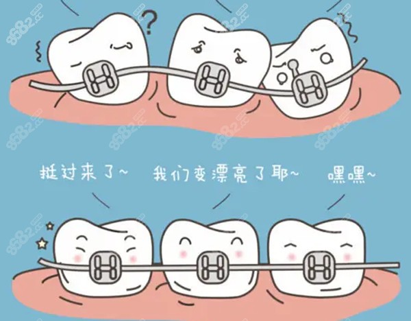 青岛口腔医院牙齿矫正价目表