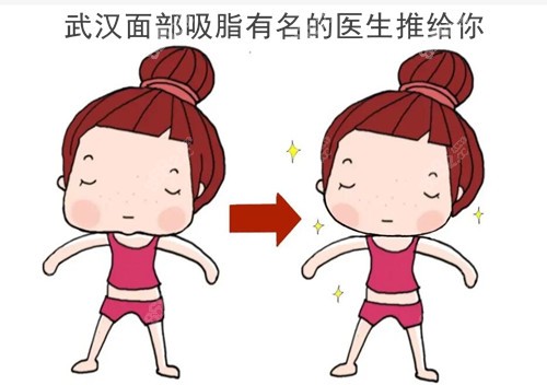 武汉面部吸脂有名的医生来了
