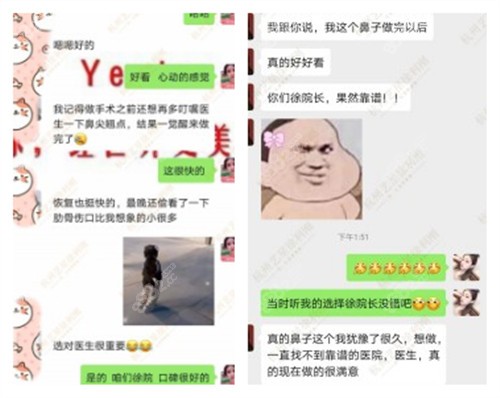 杭州艺星徐利刚做鼻子怎么样