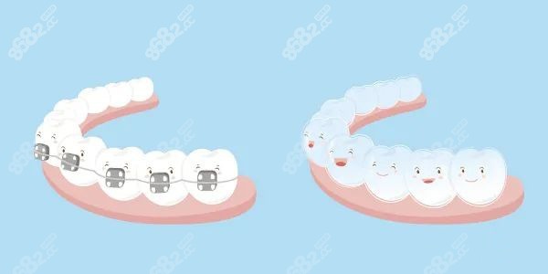 泸州微笑口腔金属牙齿矫正价格降了