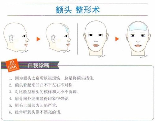 韩国雕刻后脑勺填充技术优势介绍