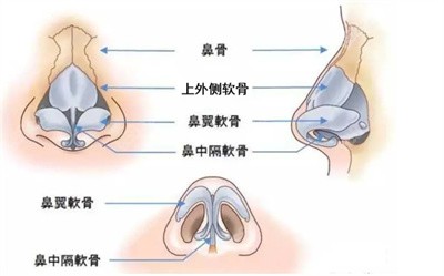 余萌医生在隆鼻方面的技术优势3