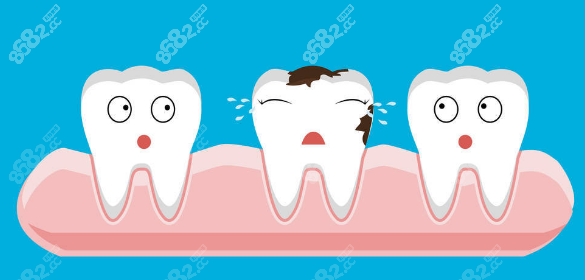 福州美可普种植牙多少钱