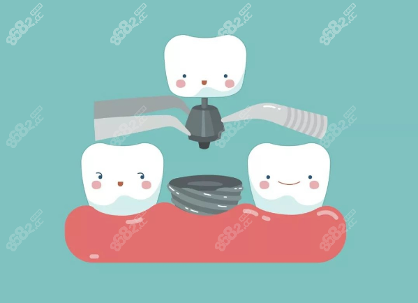 福州美可普种植牙医生