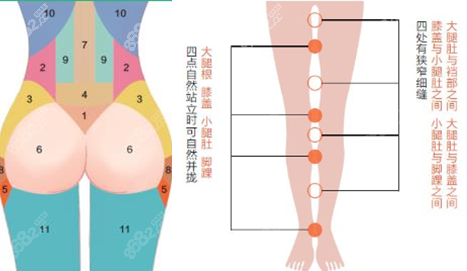 北京禾美嘉整形吸脂塑形优势