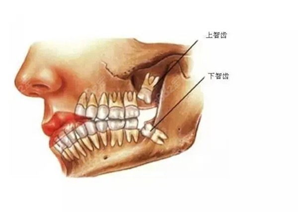 人体口腔牙位和智齿的图片