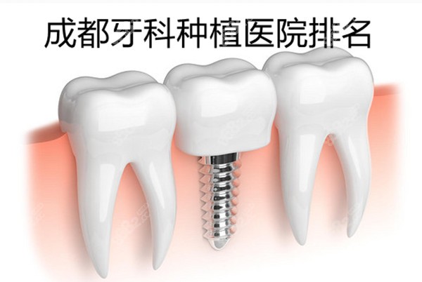 成都牙科种植医院排名 成都牙科种植医院排名