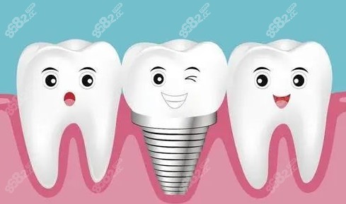 南通种植牙多少钱一颗 南通种植牙多少钱一颗