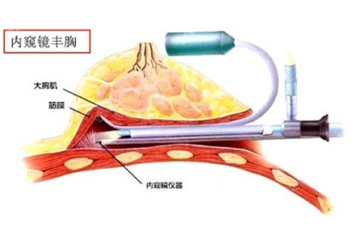 合肥华美赵辑院长做胸怎么样