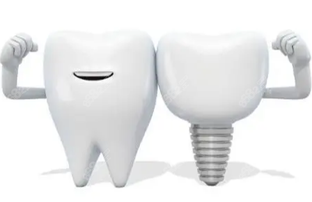 深圳种植牙价格