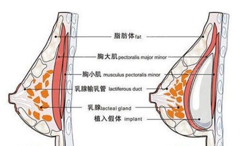 <!--<i data=20240705-sp></i>-->24小时极速丰胸技术