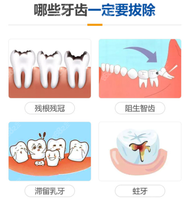 南宁拔智齿去哪个医院好