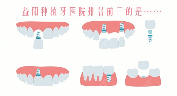 益阳种植牙医院排名前三的