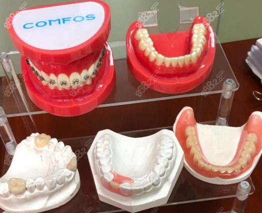 香山牙科的牙套模型