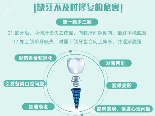 北京钛植种植牙优势